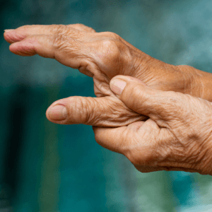 Lees hier wat je bij reuma kan verwachten en welke hulpmiddelen iemand kunnen ondersteunen. Lees hier wat je bij reuma kan verwachten en welke hulpmiddelen iemand kunnen ondersteunen.